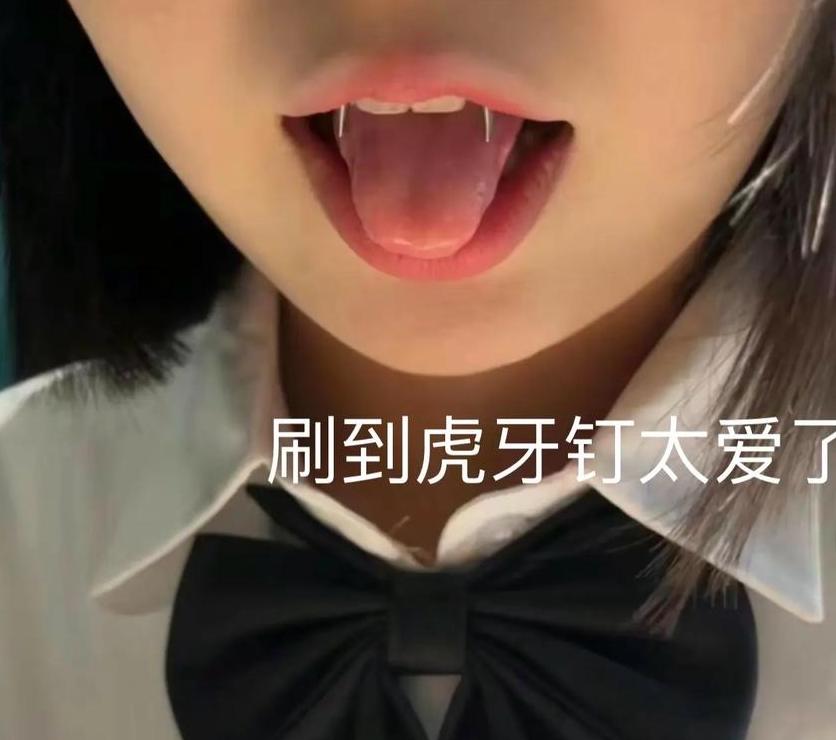 虎牙钉是什么